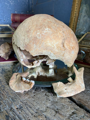 A collection of partial skull fragments from Dunwich