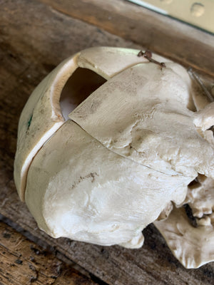 An anatomical skull model with golden eye