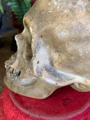 An anatomical plaster skull model