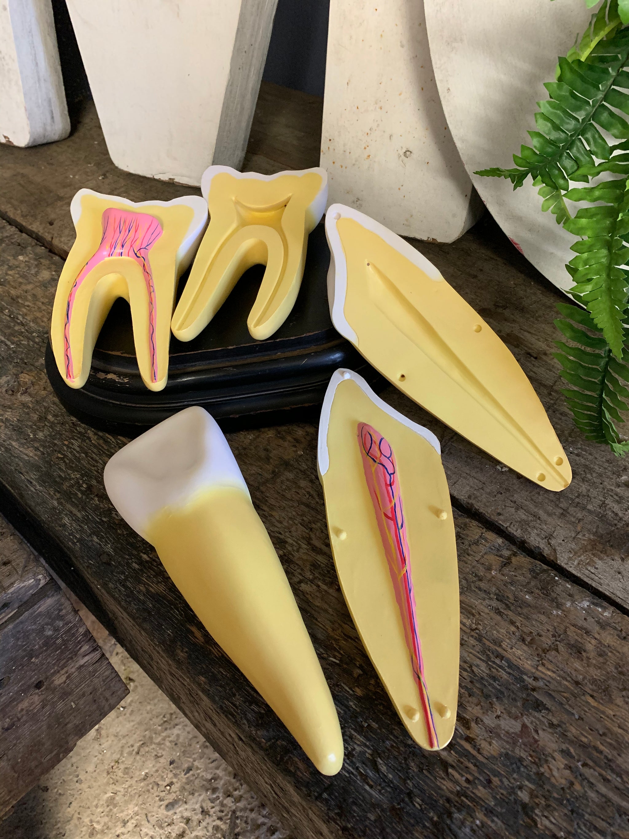 A set of three anatomical dental models of enlarged teeth - Belle and ...