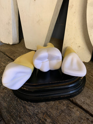 A set of three anatomical dental models of enlarged teeth