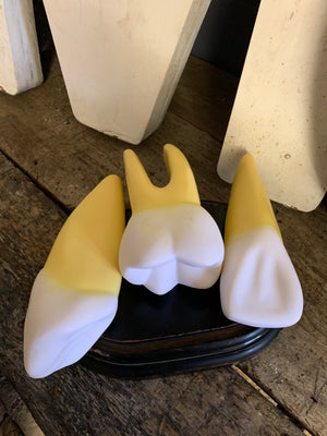 A set of three anatomical dental models of enlarged teeth