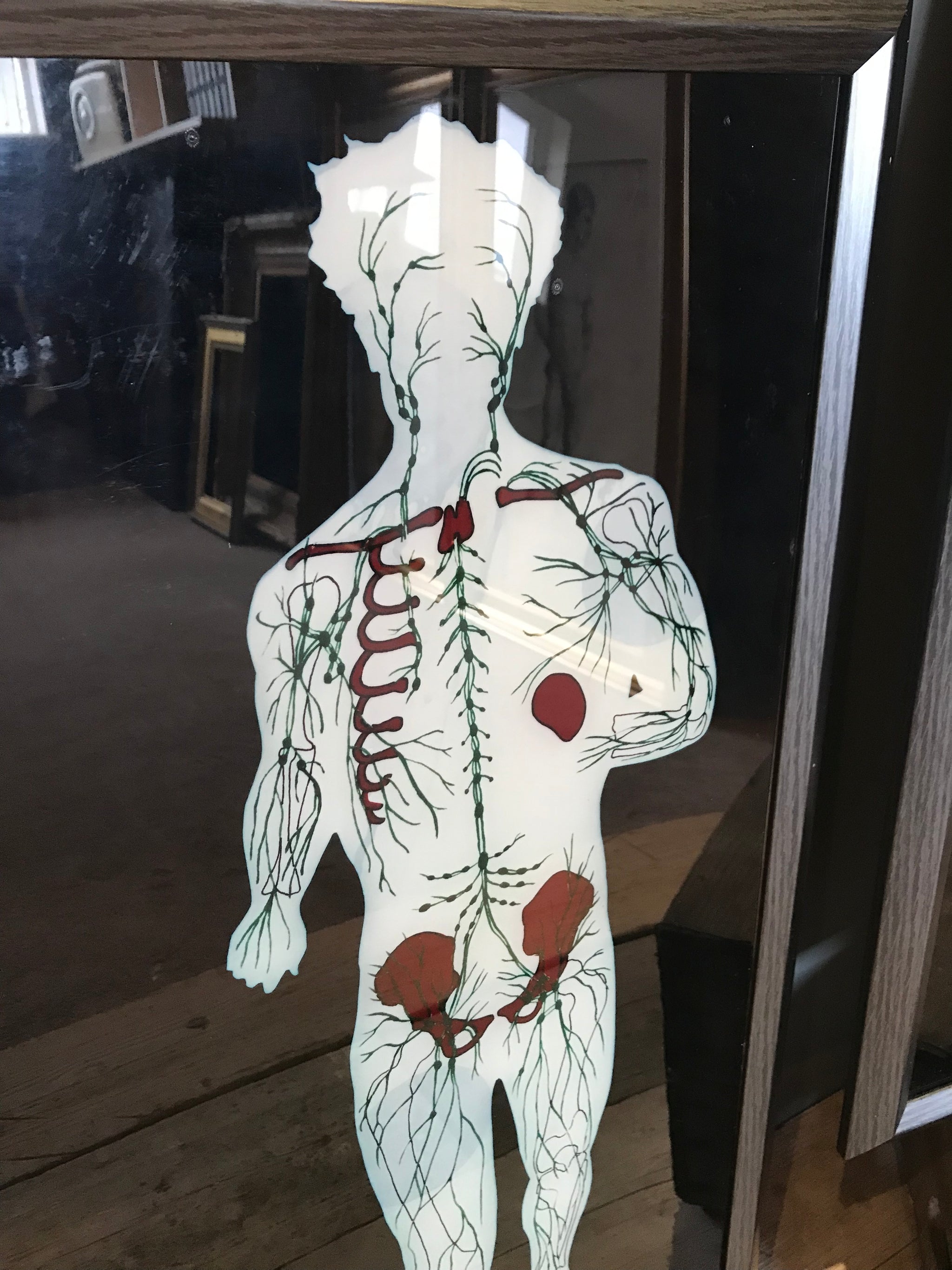 Reverse painted anatomical art on Perspex