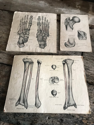 A trio of skeletal medical teaching charts