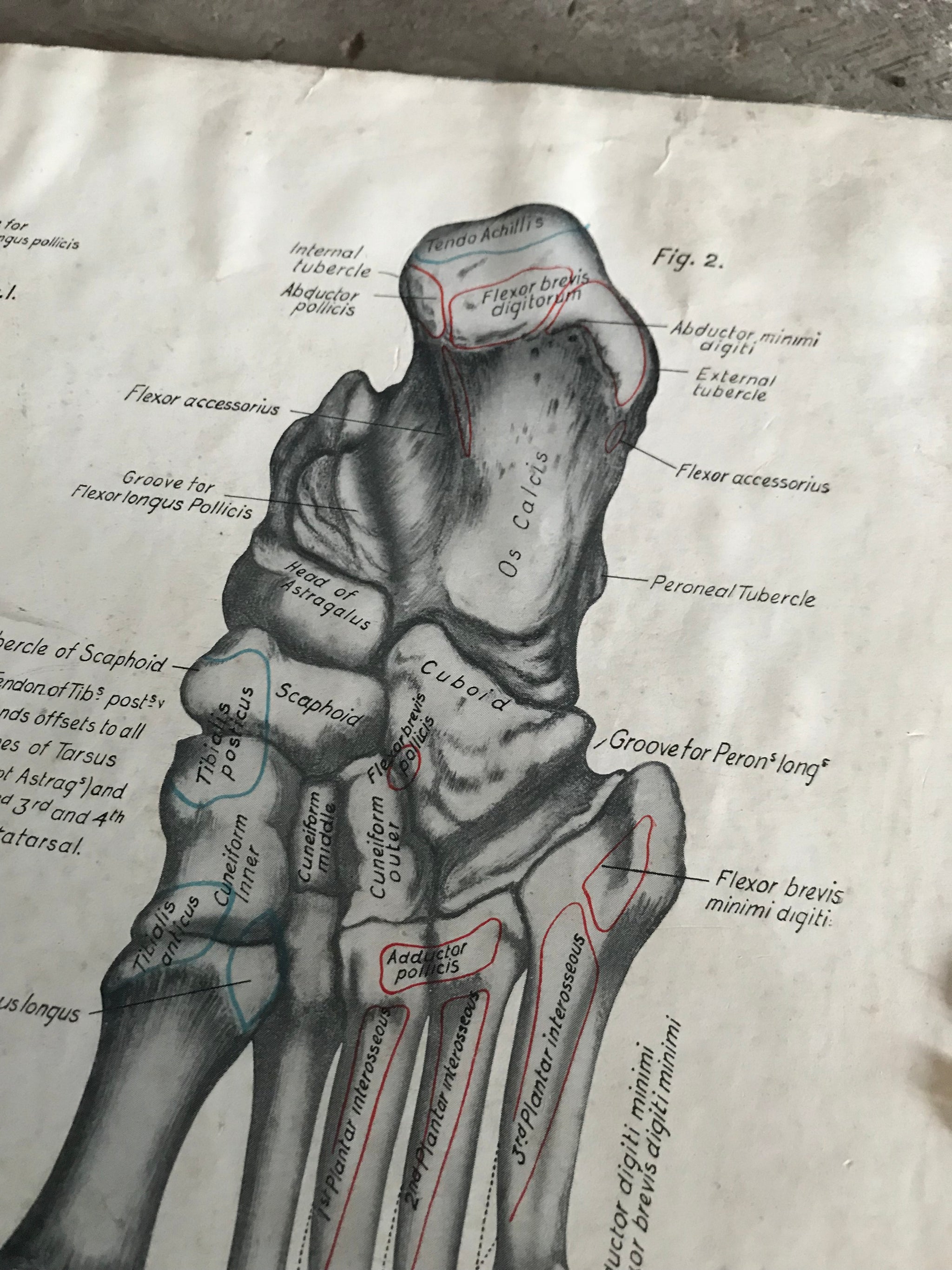 A trio of skeletal medical teaching charts