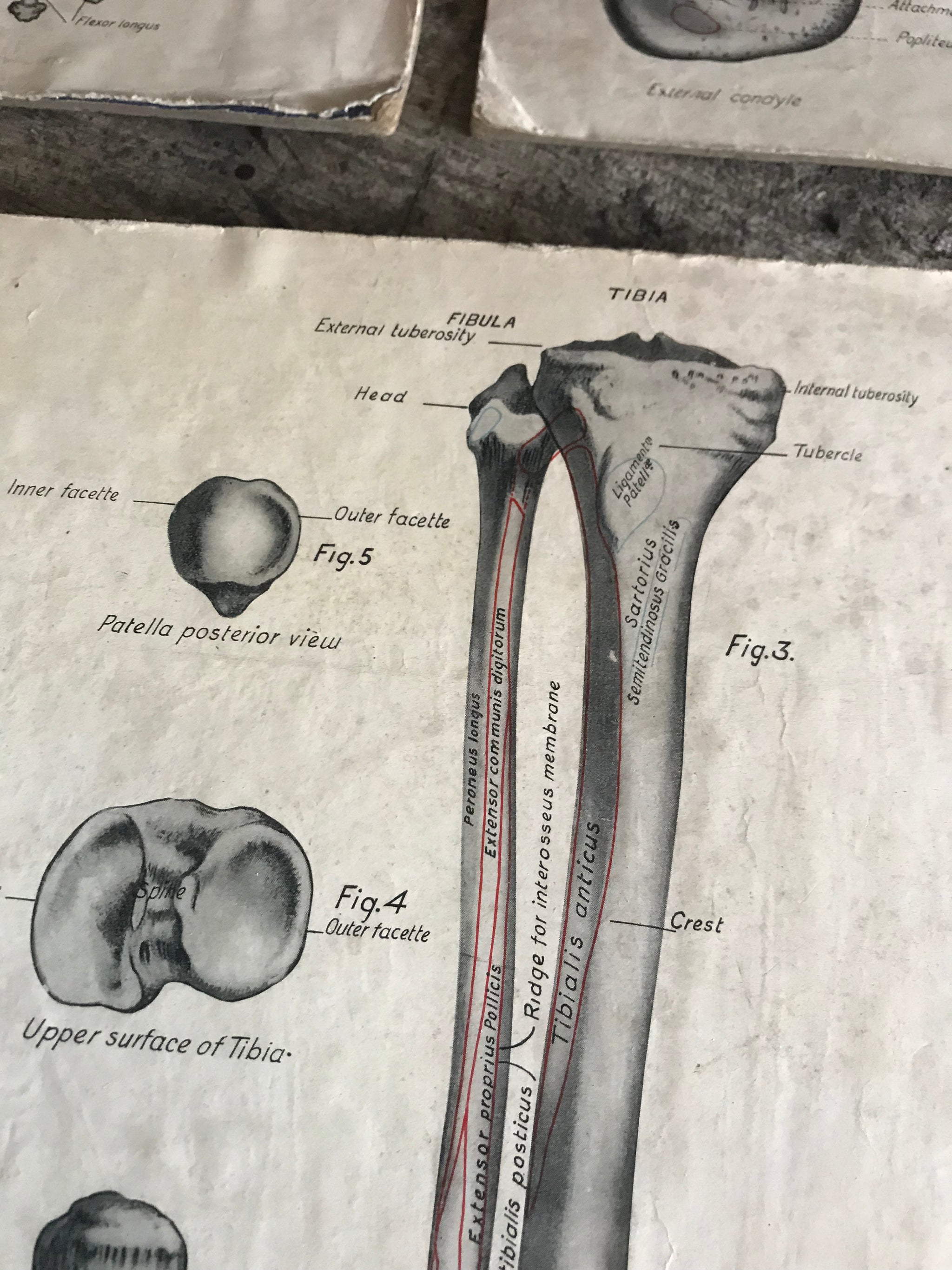 A trio of skeletal medical teaching charts