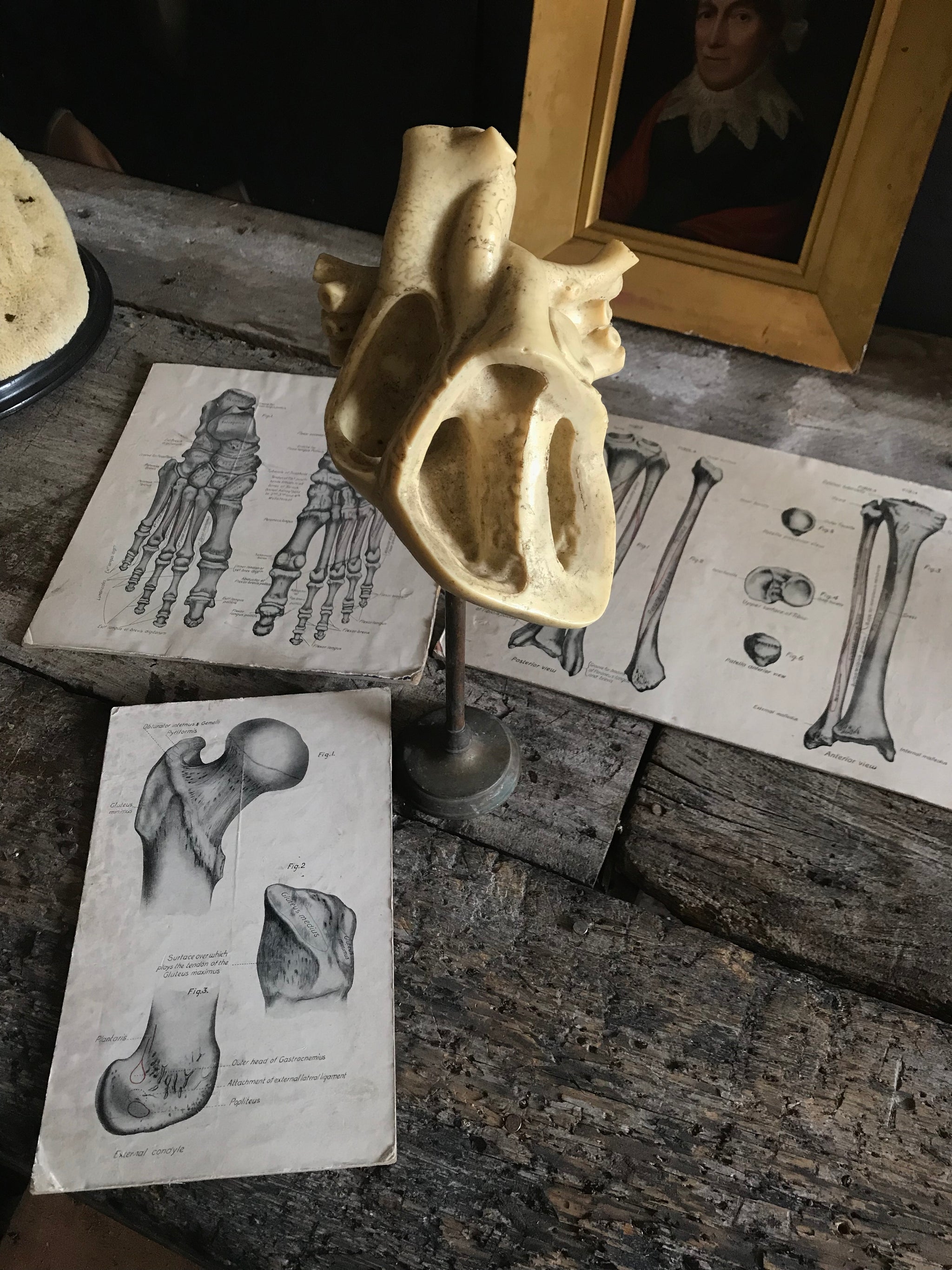 A trio of skeletal medical teaching charts