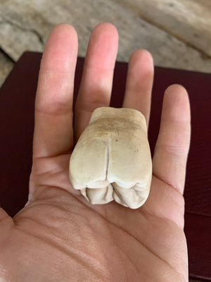 An oversized anatomical/dental plaster tooth model