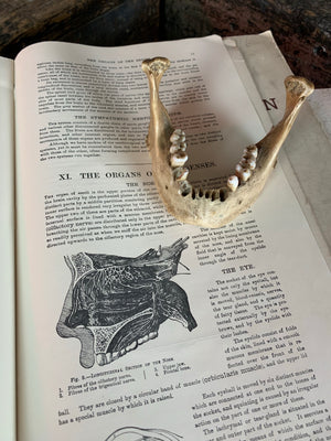 A Victorian human skull jaw bone for anatomical use