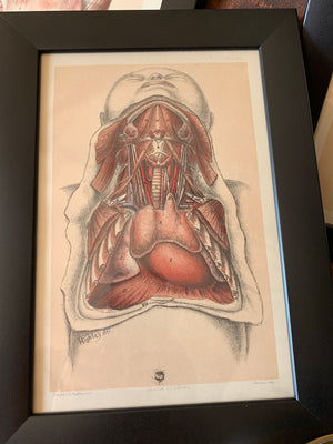 A set of 3 anatomical antiquarian bookplates of dissection- Brodie, Highley and Berjeau