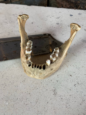 A Victorian human skull jaw bone for anatomical use