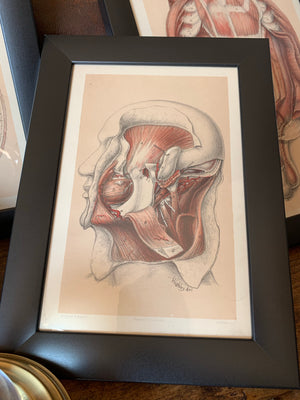 A set of 3 anatomical antiquarian bookplates of dissection- Brodie, Highley and Berjeau