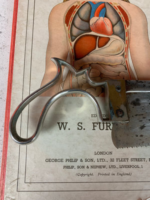 A Weiss and Son of London surgeon's medical amputation saw