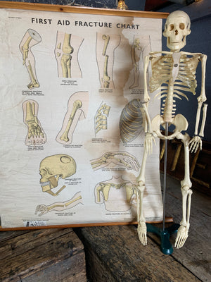 An Adam Rouilly anatomical bone fracture wall chart