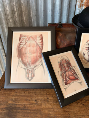 A pair of anatomical antiquarian bookplates of dissection- Brodie, Highley and Berjeau