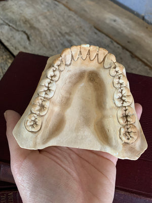 An oversized anatomical/dental plaster teeth model