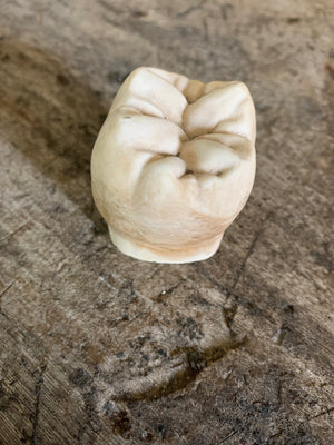 An oversized anatomical/dental plaster tooth model