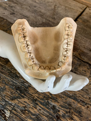 An oversized anatomical/dental plaster teeth model
