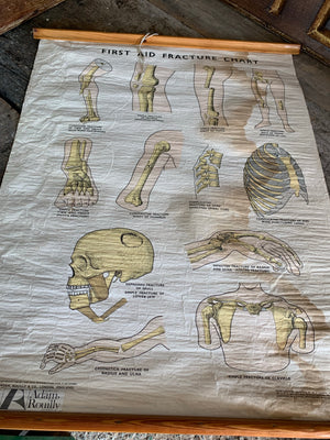 An Adam Rouilly anatomical bone fracture wall chart
